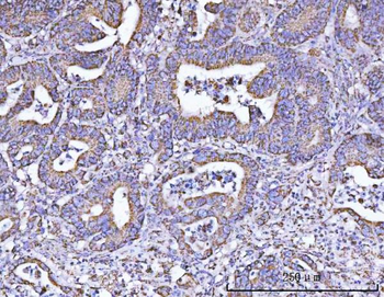 ATP5F1B Rabbit Polyclonal Antibody