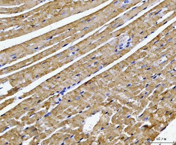 ATP5F1B Rabbit Polyclonal Antibody