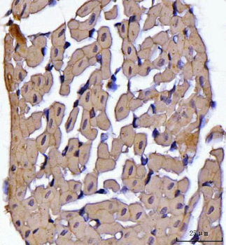 ATP5F1B Rabbit Polyclonal Antibody