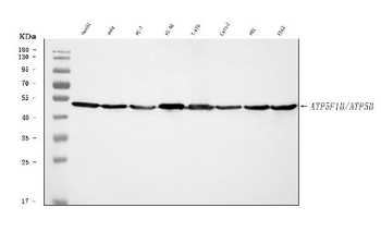 ATP5F1B Rabbit Polyclonal Antibody