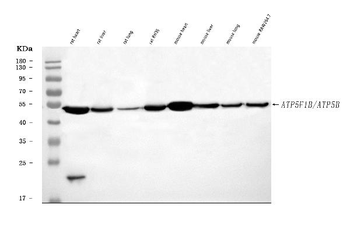 ATP5F1B Rabbit Polyclonal Antibody