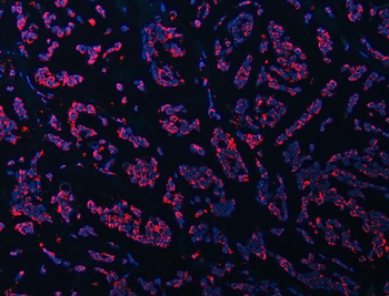 ATP5F1B Rabbit Polyclonal Antibody