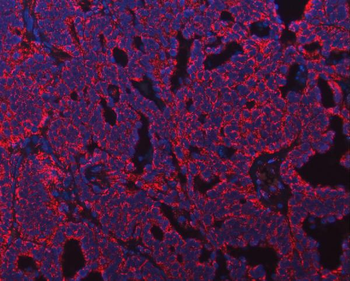 ATP5F1B Rabbit Polyclonal Antibody