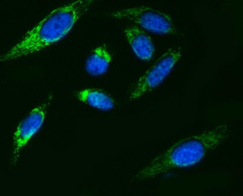 ATP5F1B Rabbit Polyclonal Antibody