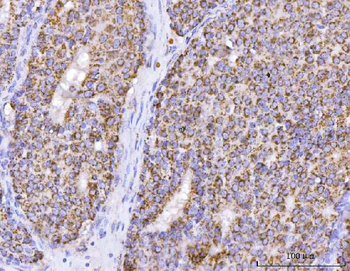 ATP5F1B Rabbit Polyclonal Antibody