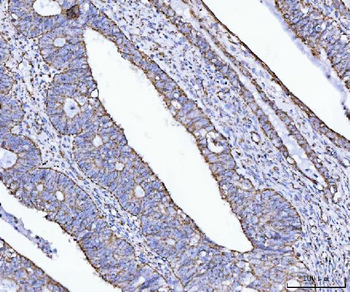 ATP5F1B Rabbit Polyclonal Antibody