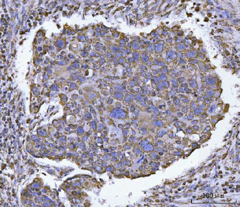 ATP5F1B Rabbit Polyclonal Antibody