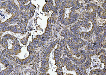 ATP5F1B Rabbit Polyclonal Antibody