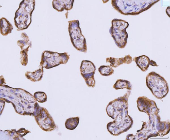 ATP5F1B Rabbit Polyclonal Antibody
