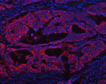 ATP5F1A Rabbit Polyclonal Antibody
