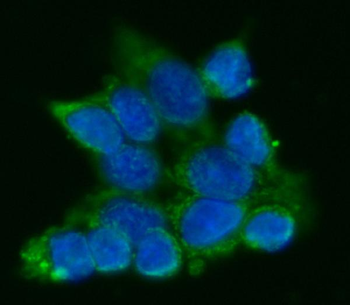 ATP5F1A Rabbit Polyclonal Antibody