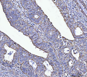 ATP5F1A Rabbit Polyclonal Antibody