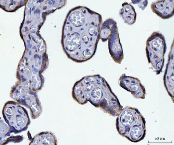 ATP5F1A Rabbit Polyclonal Antibody