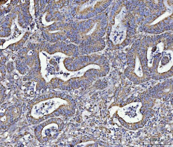 ATP5F1A Rabbit Polyclonal Antibody