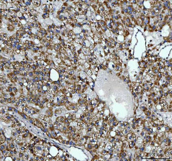 AGPS Rabbit Polyclonal Antibody