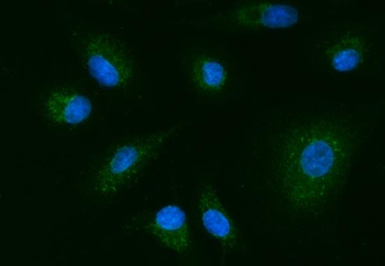 YWHAE Rabbit Polyclonal Antibody