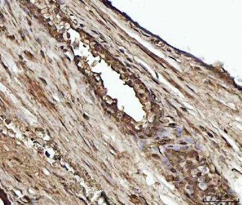 YWHAE Rabbit Polyclonal Antibody