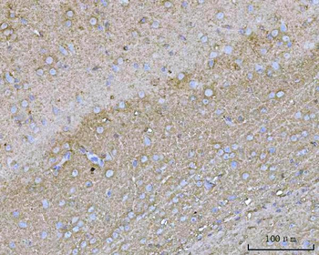 YWHAE Rabbit Polyclonal Antibody