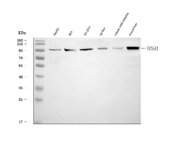 VPS41 Rabbit Polyclonal Antibody