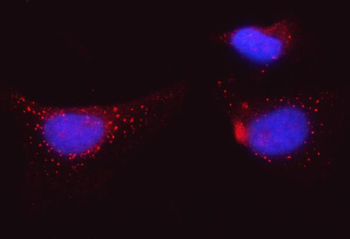 BI-1/TMBIM6/BI Rabbit Polyclonal Antibody