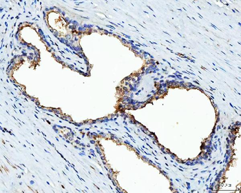 BI-1/TMBIM6/BI Rabbit Polyclonal Antibody