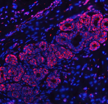 RPL32 Rabbit Polyclonal Antibody