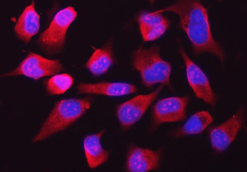 RPL32 Rabbit Polyclonal Antibody