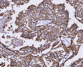 MTHFD1 Rabbit Polyclonal Antibody