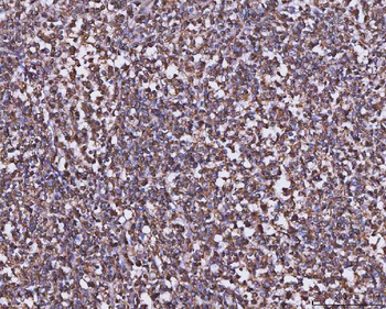 MTHFD1 Rabbit Polyclonal Antibody
