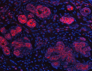 IMPDH2 Rabbit Polyclonal Antibody