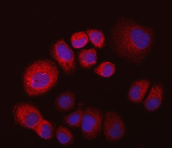 IMPDH2 Rabbit Polyclonal Antibody