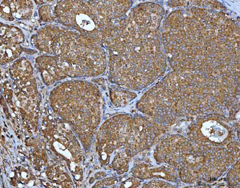 IMPDH2 Rabbit Polyclonal Antibody
