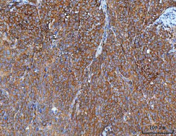 IMPDH2 Rabbit Polyclonal Antibody