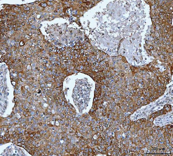 IMPDH2 Rabbit Polyclonal Antibody