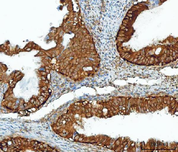 IMPDH2 Rabbit Polyclonal Antibody
