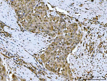 HSF1 Rabbit Polyclonal Antibody