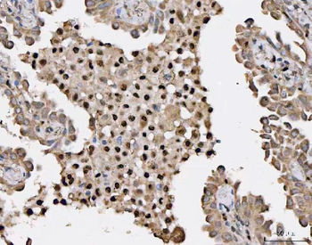 HSF1 Rabbit Polyclonal Antibody