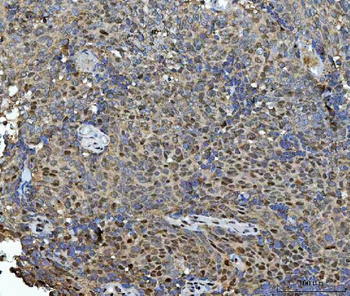 HSF1 Rabbit Polyclonal Antibody