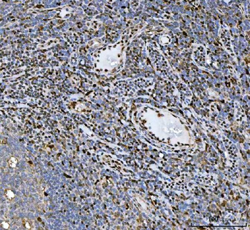 HSF1 Rabbit Polyclonal Antibody