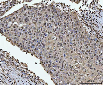 HOXC4 Rabbit Polyclonal Antibody