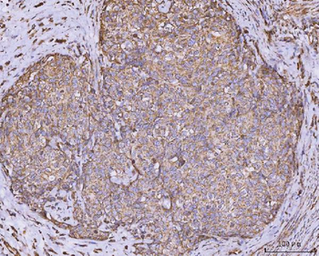 CLASP1 Rabbit Polyclonal Antibody