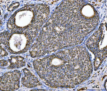 Aconitase 2 Mouse Monoclonal Antibody
