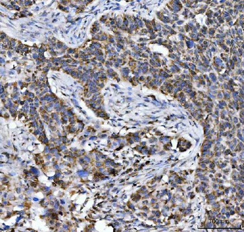 Aconitase 2 Mouse Monoclonal Antibody