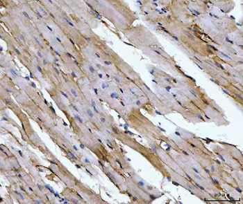 Aconitase 2 Mouse Monoclonal Antibody