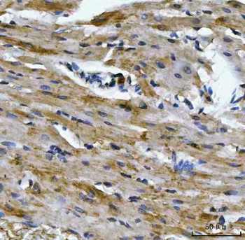 Aconitase 2 Mouse Monoclonal Antibody