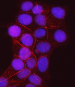 gamma Catenin Mouse Monoclonal Antibody