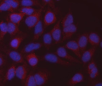 MDH2 Mouse Monoclonal Antibody