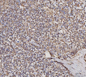 MDH2 Mouse Monoclonal Antibody