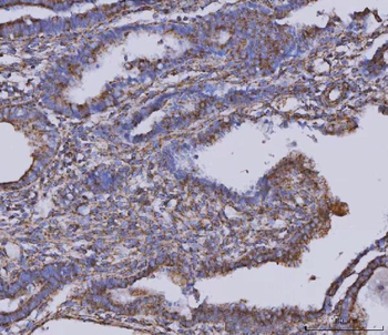 MDH2 Mouse Monoclonal Antibody