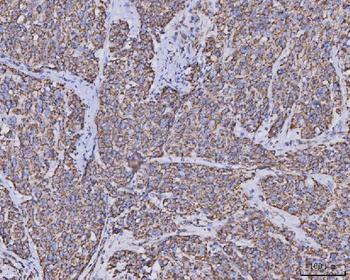 MDH2 Mouse Monoclonal Antibody